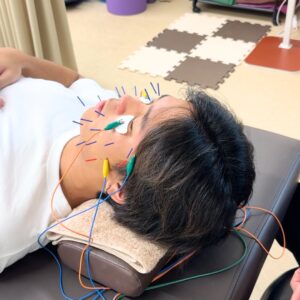 8,000円相当の電気美容鍼が半額!
